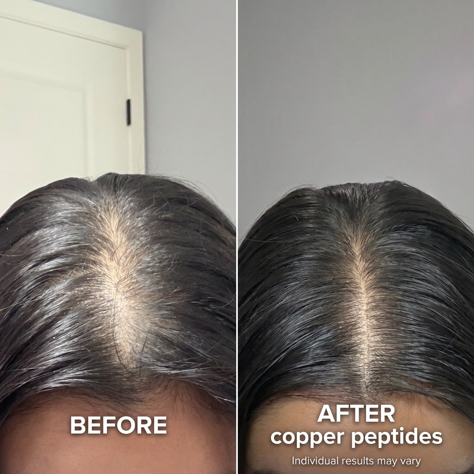Suero para el crecimiento del cabello con péptidos de cobre