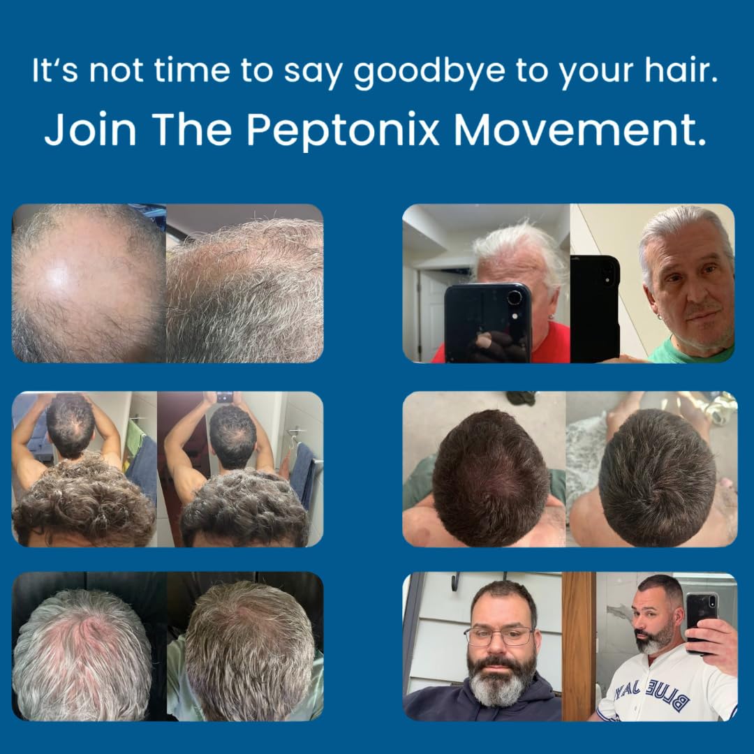 Micro-Infusion Peptide System For Hair Regrowth.