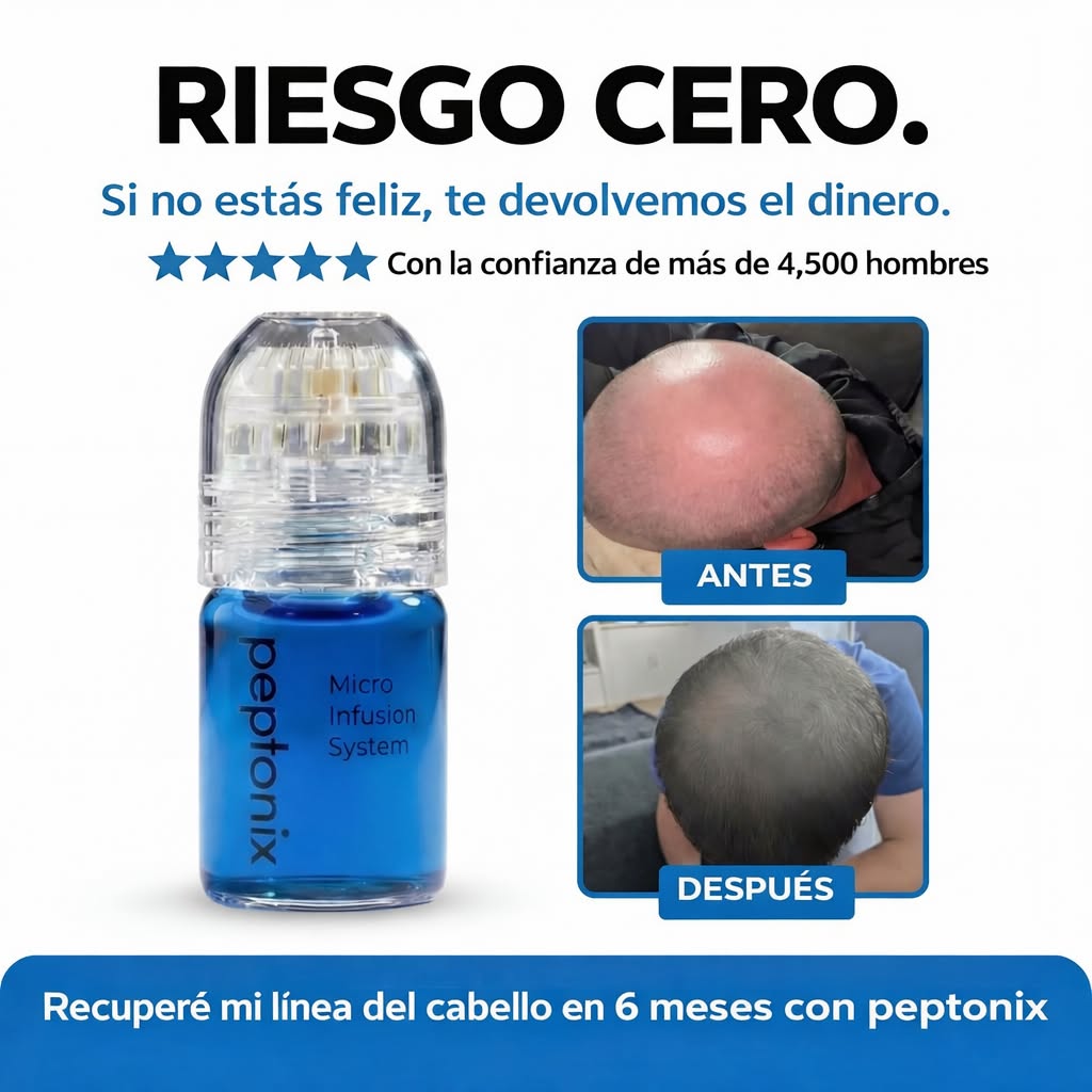 Microinfusión de péptidos para el crecimiento del cabello.