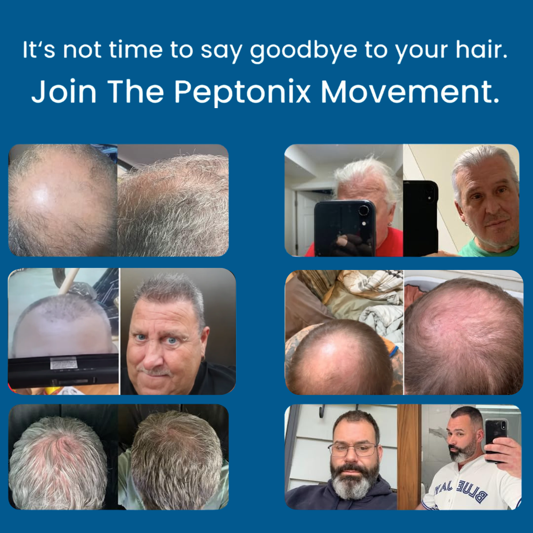 Micro-Infusion Peptide System For Hair Regrowth.