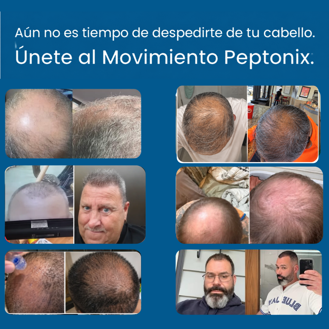 Microinfusión de péptidos para el crecimiento del cabello.