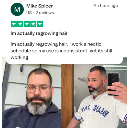Fórmula para el recrecimiento del cabello con péptidos de cobre