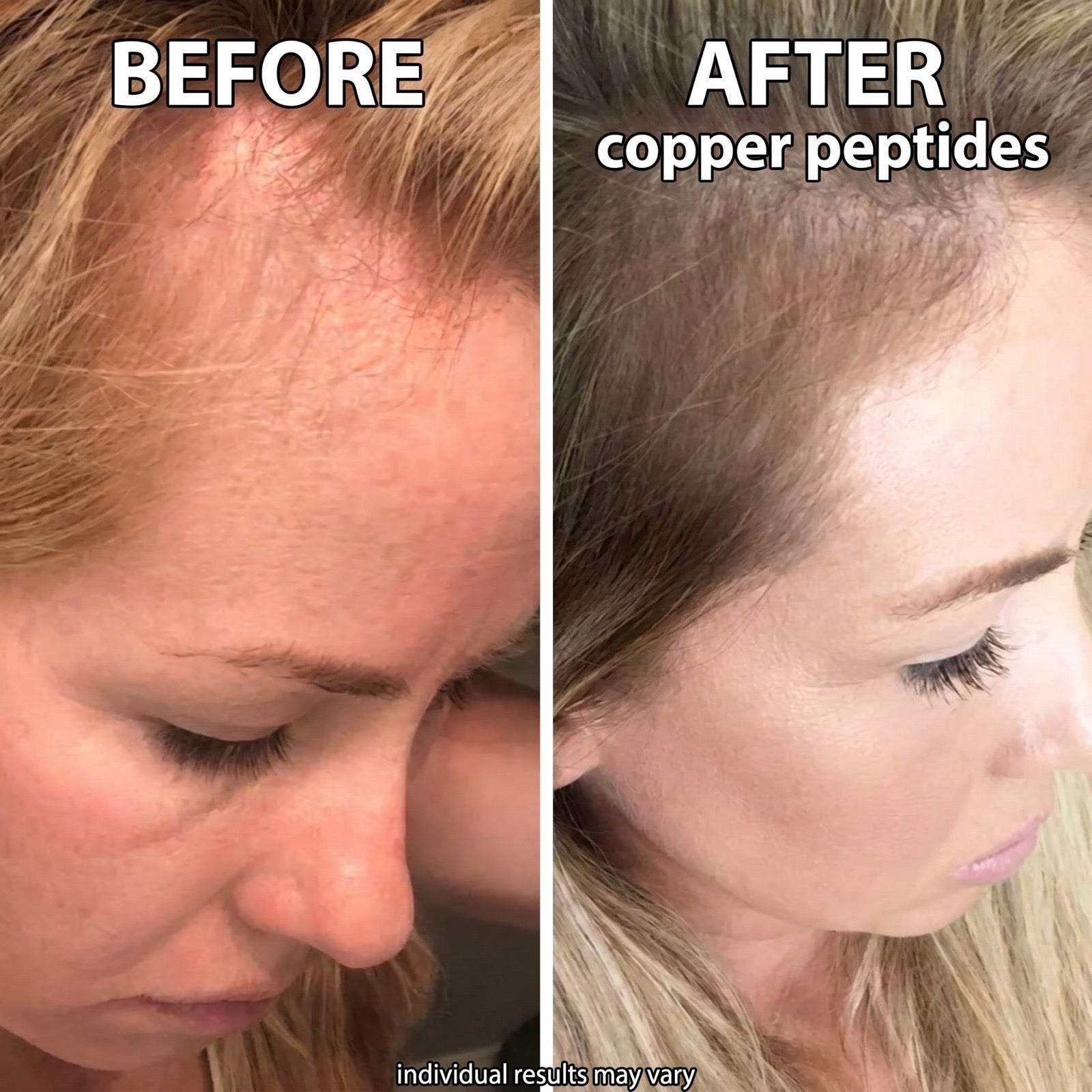 Suero para el crecimiento del cabello con péptidos de cobre