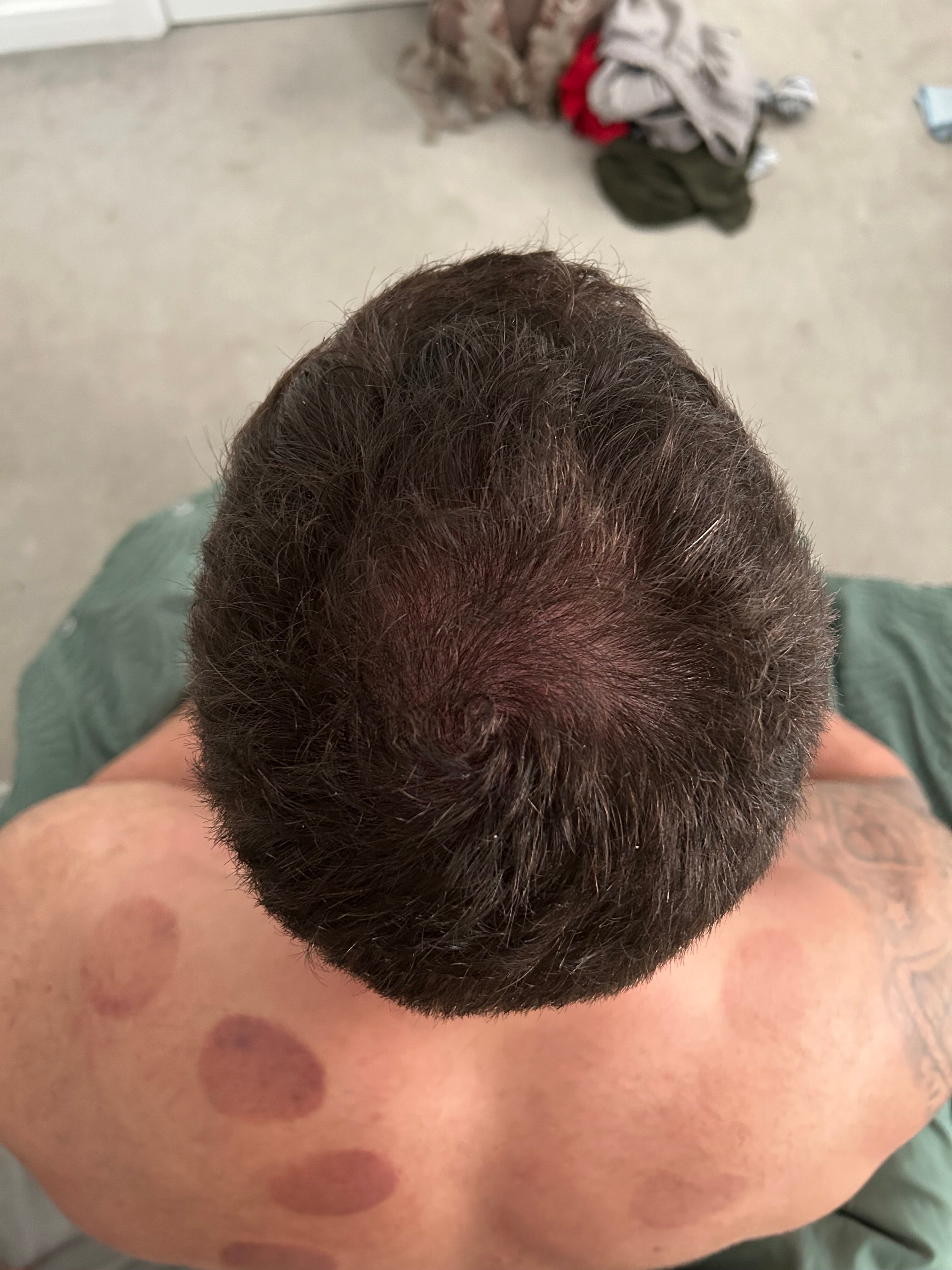 Cabello de khaled antes de usar Peptonix
