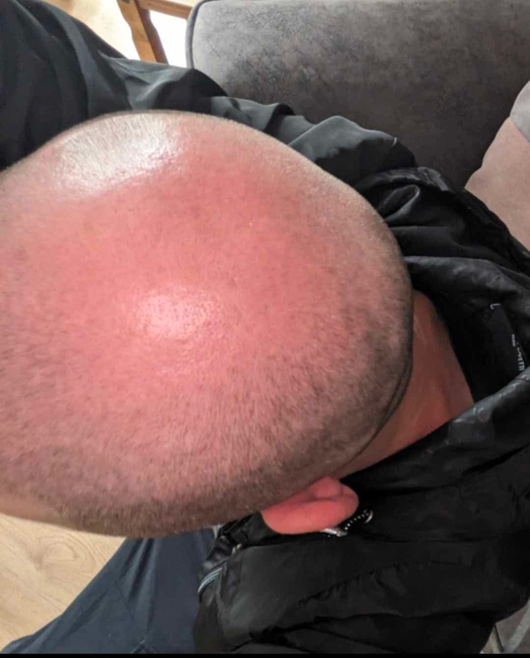 Cabello de selvin antes de usar Peptonix