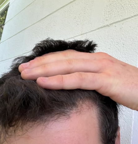 Cabello de tim después de usar Peptonix