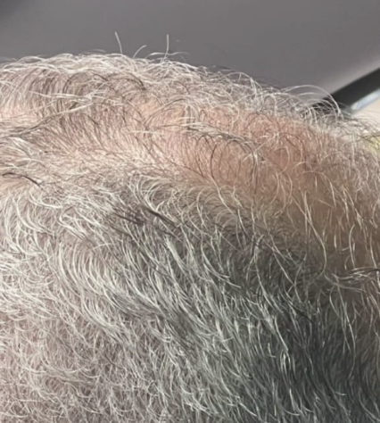 Cabello de daniel después de usar Peptonix